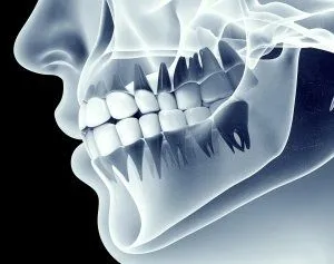 iStock 77097345 MEDIUM dental Xray 300x237 1 - Georgia Microendodontics