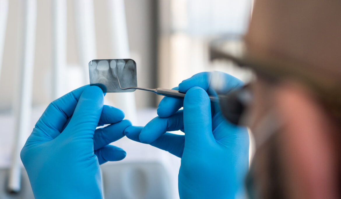 Dentist looks at X-ray of teeth